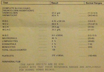 Dog Liver Enzymes Normal Range Chart